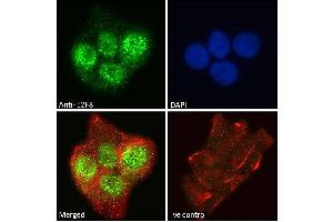 ABIN570707 Immunofluorescence analysis of paraformaldehyde fixed A431 cells, permeabilized with 0. (E2F8 抗体  (Internal Region))