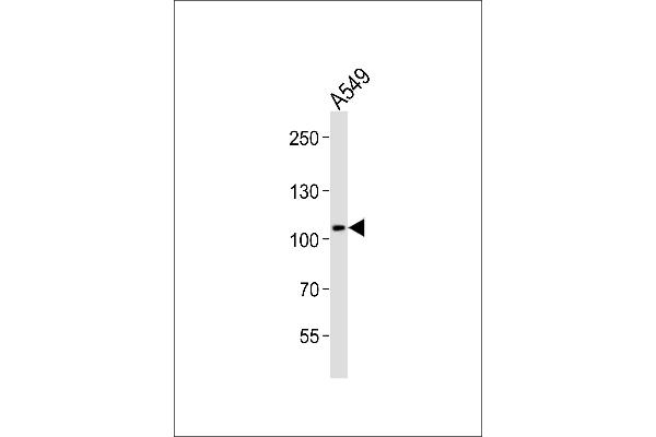 COG1 抗体  (C-Term)