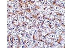 Immunohistochemistry (IHC) image for anti-Tumor Necrosis Factor Receptor Superfamily, Member 12A (TNFRSF12A) antibody (ABIN1031803) (TNFRSF12A 抗体)