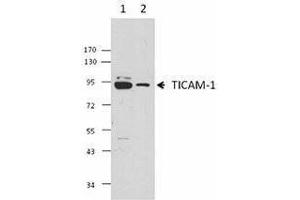 Western Blotting (WB) image for anti-Toll-Like Receptor Adaptor Molecule 1 (TICAM1) antibody (ABIN2665411) (TICAM1 抗体)