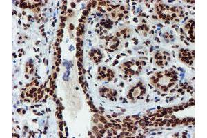 Immunohistochemical staining of paraffin-embedded Human breast tissue using anti-PADI4 mouse monoclonal antibody.