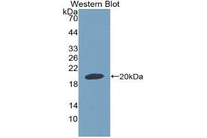 Western blot analysis of the recombinant protein. (GDF9 抗体  (AA 306-440))