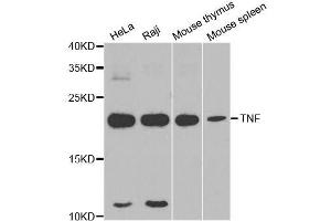 Western blot analysis of extracts of various cell lines, using TNF-α antibody. (TNF alpha 抗体)