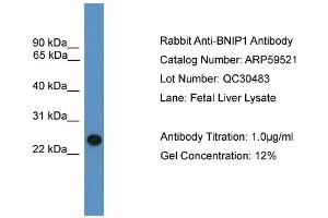 WB Suggested Anti-BNIP1  Antibody Titration: 0.