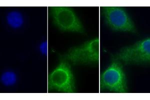 Detection of COX4I1 in Human Hela cell using Polyclonal Antibody to Cytochrome C Oxidase Subunit IV Isoform 1 (COX4I1) (COX IV 抗体  (AA 1-169))
