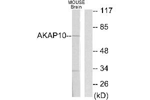 Western blot analysis of extracts from mouse brain cells, using AKAP10 antibody. (AKAP10 抗体  (Internal Region))