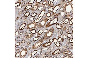 IHC analysis of SBP/SELENBP1 using anti-SBP/SELENBP1 antibody (ABIN7600755). (SELENBP1 抗体  (AA 23-462))
