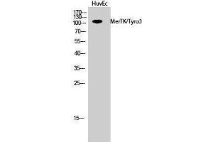 Western Blotting (WB) image for anti-MerTK/Tyro3 (MerTK/Tyro3) (Ser1181) antibody (ABIN3180727) (MerTK/Tyro3 抗体  (Ser1181))