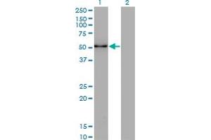 Western Blot analysis of ZSCAN21 expression in transfected 293T cell line by ZNF38 monoclonal antibody (M16), clone 4F10. (ZSCAN21 抗体  (AA 136-224))