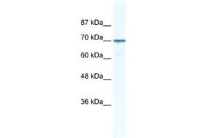 WB Suggested Anti-LAS1L Antibody Titration: 0. (LAS1L 抗体  (Middle Region))