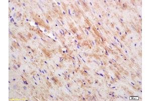 Formalin-fixed and paraffin embedded mouse heart labeled with Rabbit Anti CKMT/Creatine kinase MT Polyclonal Antibody, Unconjugated (ABIN717536) at 1:200 followed by conjugation to the secondary antibody and DAB staining