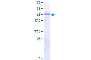 PAX9 Protein (AA 1-341) (GST tag)