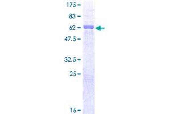 PAX9 Protein (AA 1-341) (GST tag)