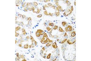 Immunohistochemistry of paraffin-embedded human stomach using CCL2 antibody (ABIN4903158) at dilution of 1:100 (40x lens). (CCL2 抗体)