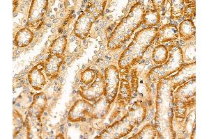 ABIN6256606 and ABIN6268850 at 1/100 staining Rat kidney tissue by IHC-P.