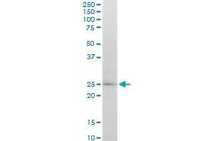 ATG5 monoclonal antibody (M04), clone 1G11. (ATG5 抗体  (AA 176-275))