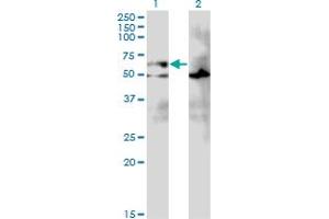 Western Blot analysis of EIF2A expression in transfected 293T cell line by EIF2A monoclonal antibody (M01), clone 3D5. (EIF2A 抗体  (AA 1-100))