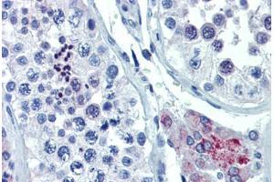 Human Testis (formalin-fixed, paraffin-embedded) stained with ASH2L antibody ABIN462194 followed by biotinylated goat anti-rabbit IgG secondary antibody ABIN481713, alkaline phosphatase-streptavidin and chromogen. (ASH2L 抗体  (AA 288-337))