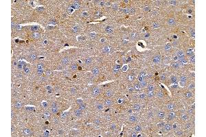 ABIN6258366 and ABIN6275720 at 1/100 staining rat brain tissue by IHC-P. (IKZF2 抗体  (Internal Region))