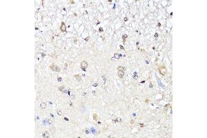 Immunohistochemistry (Paraffin-embedded Sections) (IHC (p)) image for anti-Yes-Associated Protein 1 (YAP1) antibody (ABIN1683302)