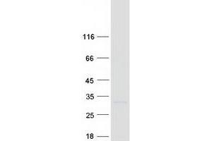 Western Blotting (WB) image for B-Cell CLL/lymphoma 2 (BCL2) protein (Myc-DYKDDDDK Tag) (ABIN2715191)