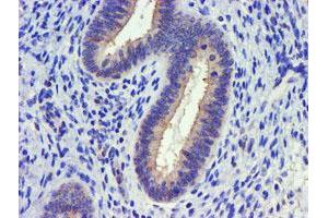 Image no. 1 for anti-Diacylglycerol Kinase, alpha 80kDa (DGKA) antibody (ABIN1497815) (DGKA 抗体)