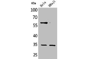 Western Blot analysis of HeLa Raji cells using CD32 Polyclonal Antibody (FCGR2B 抗体  (C-Term))