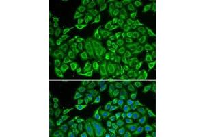 Immunofluorescence analysis of MCF7 cells using IL12RB1 Polyclonal Antibody (IL12RB1 抗体)