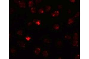 Immunofluorescencent staining of 3T3 cells with PIWIL3 polyclonal antibody  at 20 ug/mL. (PIWIL3 抗体  (N-Term))