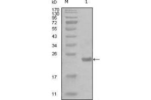 Western blot analysis using CHUK mouse mAb against truncated Trx-CHUK recombinant protein (1). (IKK alpha 抗体  (AA 500-590))