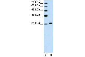 Ankyrin 1 antibody used at 1. (Erythrocyte Ankyrin 抗体  (C-Term))