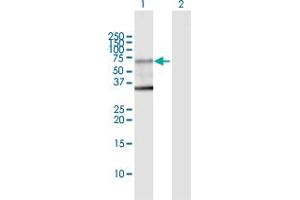 Western Blot analysis of PCTK1 expression in transfected 293T cell line by PCTK1 MaxPab polyclonal antibody.