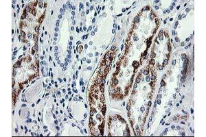 Immunohistochemical staining of paraffin-embedded Human Kidney tissue using anti-AK4 mouse monoclonal antibody. (AK4 抗体)