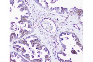 IHC analysis of INPPL1 using anti-INPPL1 antibody (ABIN6719492). (INPPL1 抗体  (AA 1172-1258))