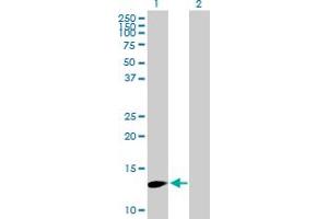 Western Blot analysis of FBXW9 expression in transfected 293T cell line by FBXW9 MaxPab polyclonal antibody. (FBXW9 抗体  (AA 1-135))