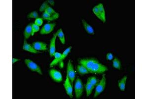 Immunofluorescent analysis of Hela cells using ABIN7145489 at dilution of 1:100 and Alexa Fluor 488-congugated AffiniPure Goat Anti-Rabbit IgG(H+L) (ENO3 抗体  (AA 7-432))