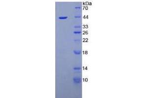 Image no. 1 for Nesfatin-1 (NES1) (AA 26-106) (Active) protein (His tag,GST tag) (ABIN6239855) (NUCB2 Protein (AA 26-106) (His tag,GST tag))