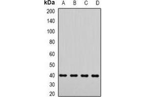 Western blot analysis of LIC3 expression in Jurkat (A), A549 (B), mouse testis (C), rat testis (D) whole cell lysates. (DYNC2LI1 抗体)