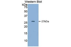 Detection of Recombinant GKN2, Mouse using Polyclonal Antibody to Gastrokine 2 (GKN2) (Gastrokine 2 抗体  (AA 21-184))