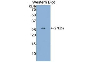 Detection of Recombinant GKN2, Mouse using Polyclonal Antibody to Gastrokine 2 (GKN2)