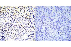Immunohistochemical analysis of paraffin- embedded human malignant lymphoma tissue using Histone H3. (Histone H3.1 抗体)
