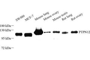 Western blot analysis of PTPN12 (ABIN7075292) at dilution of 1: 500 (PTPN12 抗体)