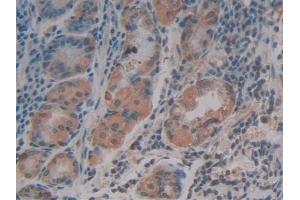 Detection of SDF1 in Human Stomach Tissue using Polyclonal Antibody to Stromal Cell Derived Factor 1 (SDF1) (CXCL12 抗体  (AA 23-89))