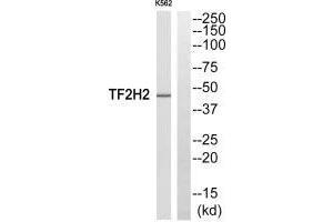 Western Blotting (WB) image for anti-General Transcription Factor IIH, Polypeptide 2, 44kDa (GTF2H2) (N-Term) antibody (ABIN7184511)