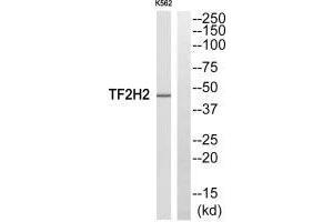 Western blot analysis of extracts from COLO205 cells, using TF2H2 antibody. (GTF2H2 抗体  (N-Term))