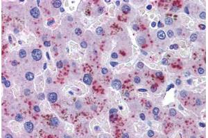 Liver, Human: Formalin-Fixed, Paraffin-Embedded (FFPE) (Hemopexin 抗体  (AA 32-45))