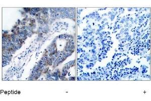 Image no. 1 for anti-Mitogen-Activated Protein Kinase Kinase Kinase 5 (MAP3K5) (Ser83) antibody (ABIN197310) (ASK1 抗体  (Ser83))