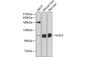 Western blot analysis of extracts of various cell lines, using LLGL2 antibody (ABIN6131794, ABIN6143262, ABIN6143265 and ABIN6224298) at 1:1000 dilution. (LLGL2 抗体  (AA 620-819))