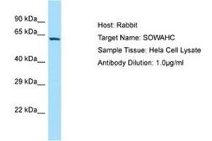 Image no. 1 for anti-Ankyrin Repeat Domain 57 (ANKRD57) (AA 128-177) antibody (ABIN6750153) (ANKRD57 抗体  (AA 128-177))