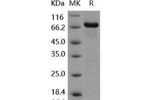 Western Blotting (WB) image for Discoidin Domain Receptor tyrosine Kinase 2 (DDR2) (Active) protein (GST tag,His tag) (ABIN7317114)